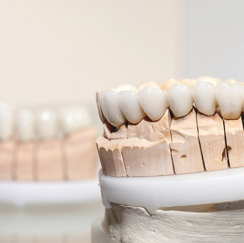 Por que especializar-se em Prótese Dentária?